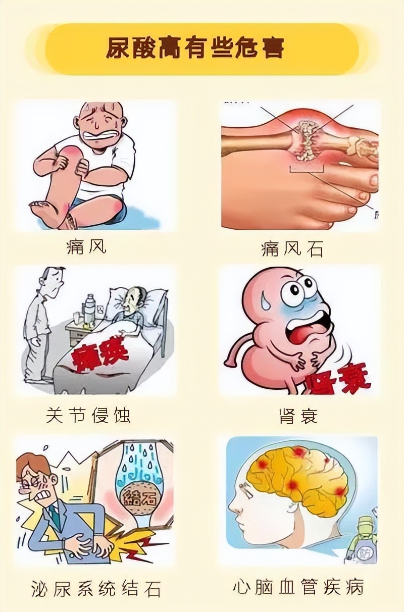 痛风患者注意：这7大误区一定要清楚