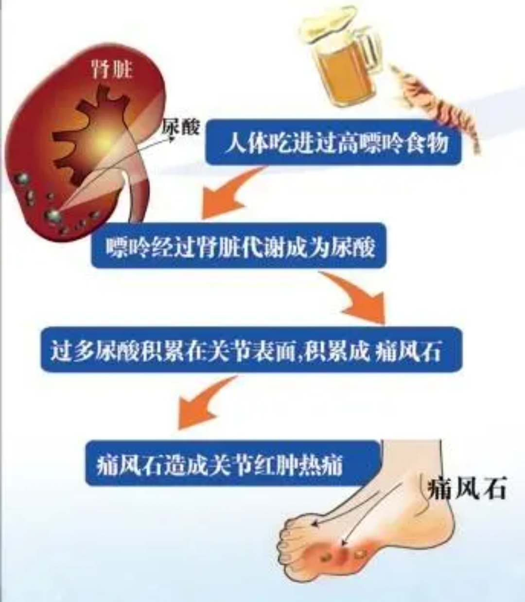 什么是痛风？痛风病因及简介，通俗易懂！（痛风君yo) 111_凤凰网视频_凤凰网