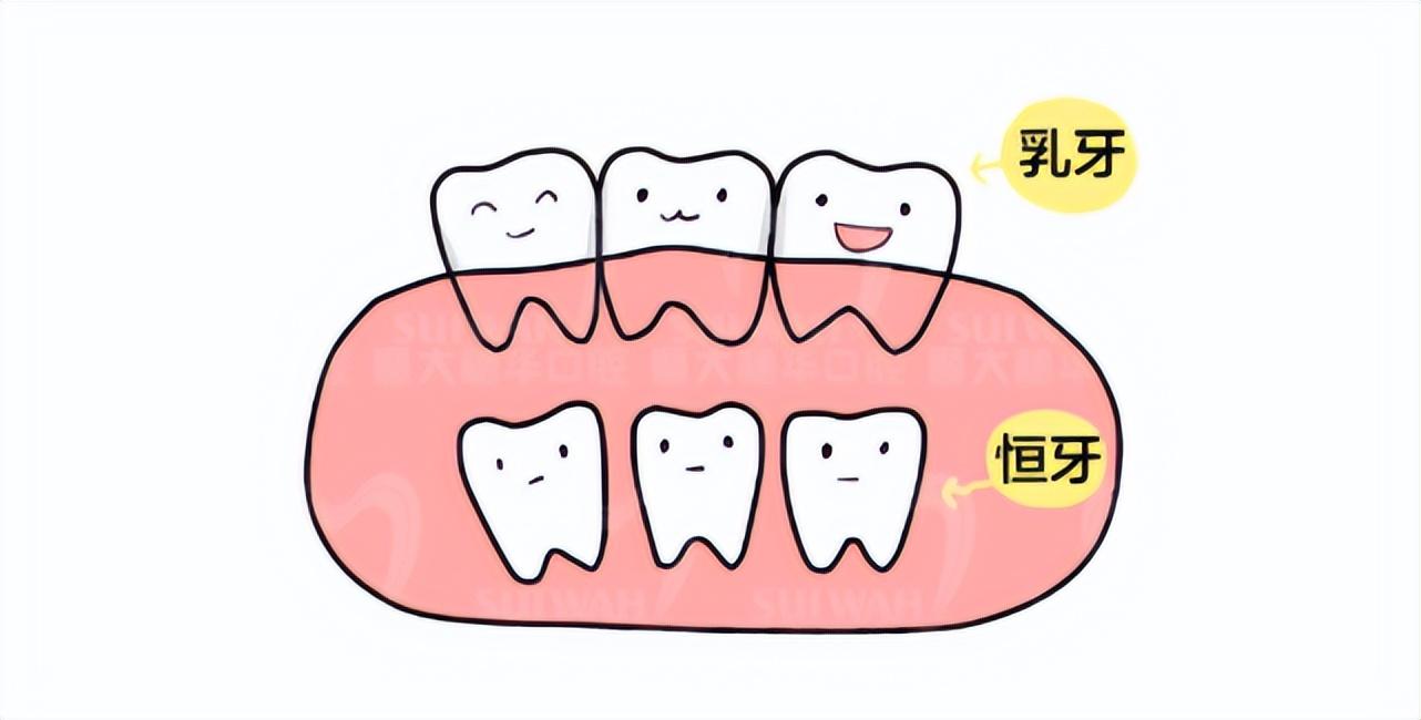 比如:换牙时乳牙滞留会造成恒牙异位萌出,前牙区多生牙会造成恒牙异位