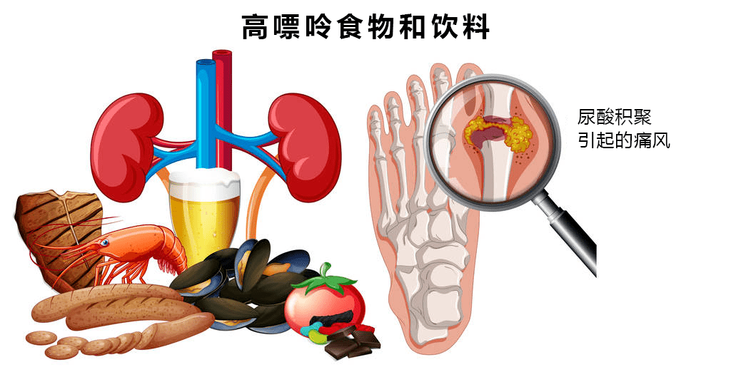 高嘌呤食物.jpeg
