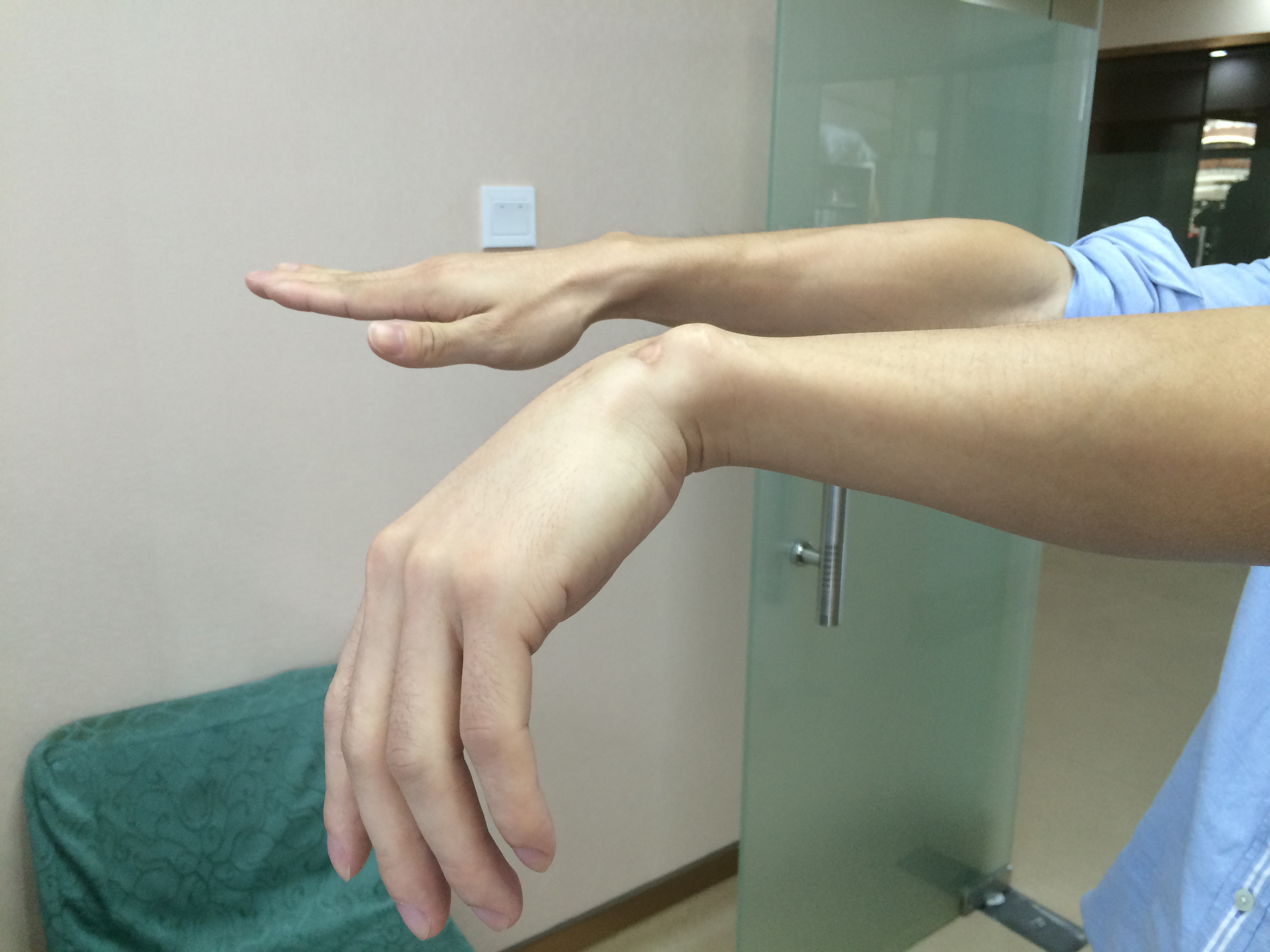手腕腱鞘炎3个动作自愈方法（专家支招，坚持揉捏按摩，可自愈）_斜杠青年工作室