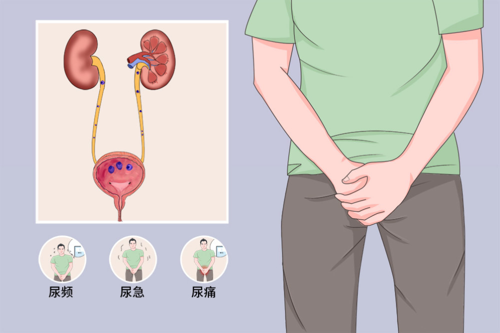 尿道炎与尿路感染如何区分?