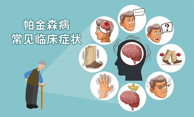 警惕！身体出现这些预警信号，须注意帕金森病来袭......|帕金森病|震颤|强直|-健康界