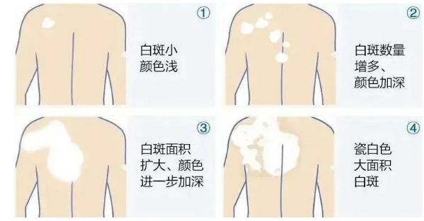 48756e744741fe4b58cf779384be8ac0.png
