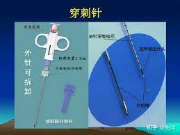 肺穿刺活检，会不会引起癌细胞扩散？ - 知乎