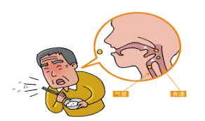 老年人吞咽困难的照护_手机搜狐网