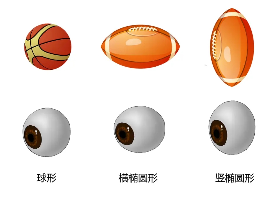 隐藏在儿童眼睛里的散光到底是什么？