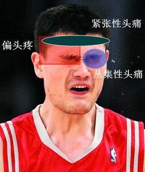 头疼.jpg