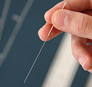 针灸.jpg