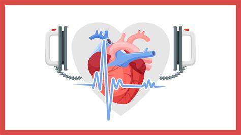 Sudden Cardiac Arrest: Meaning, Causes, How to Help