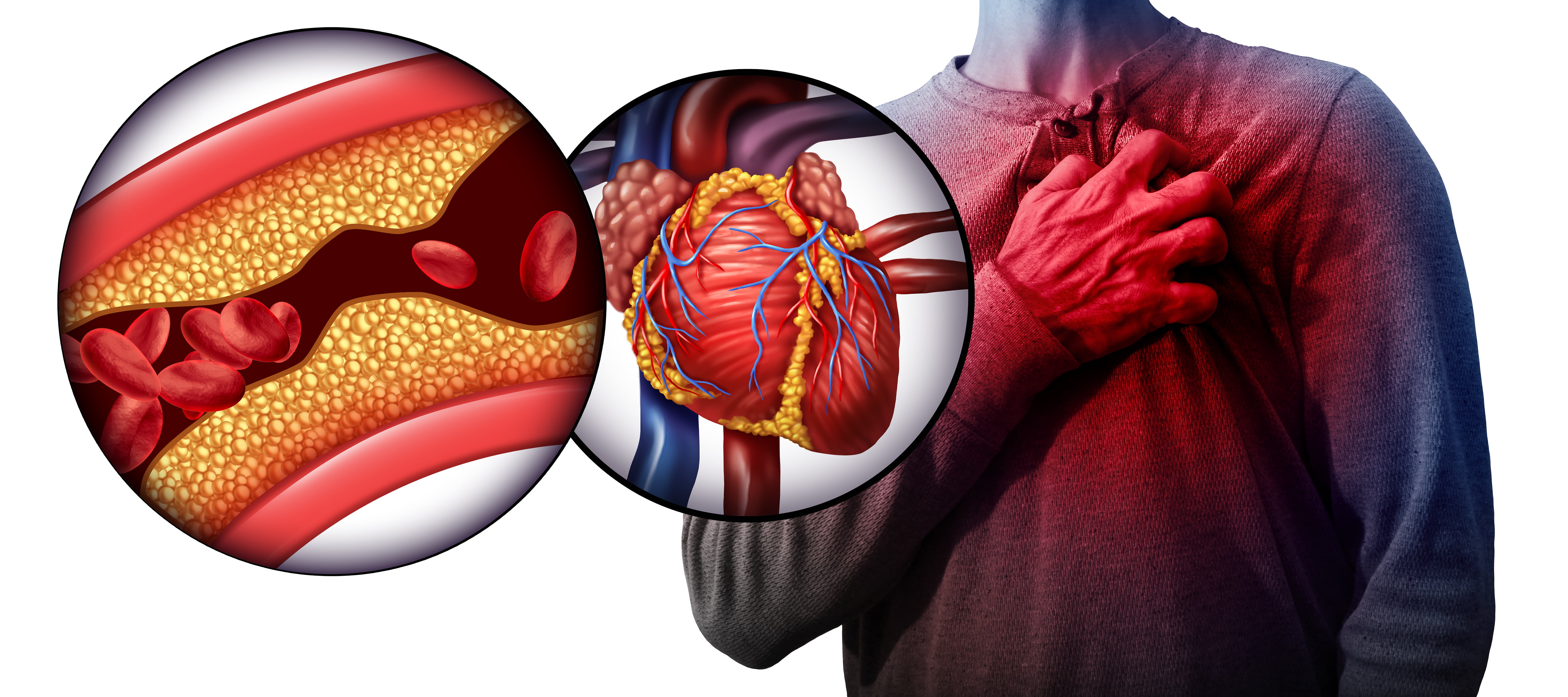 What is heart attack disease and how to treat it?