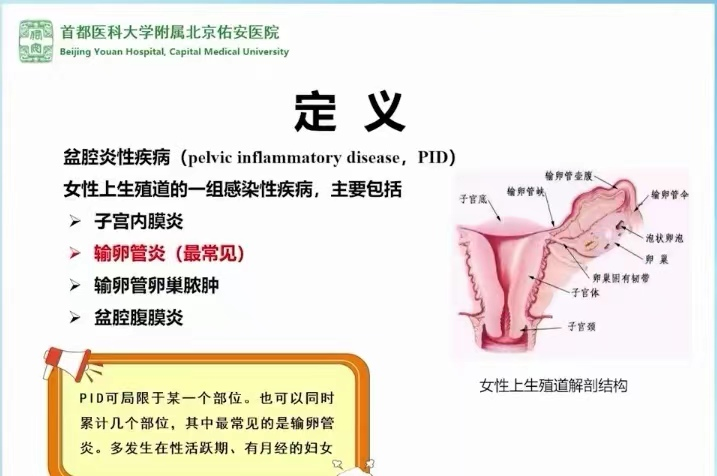 微信图片_2盆腔炎定义.png