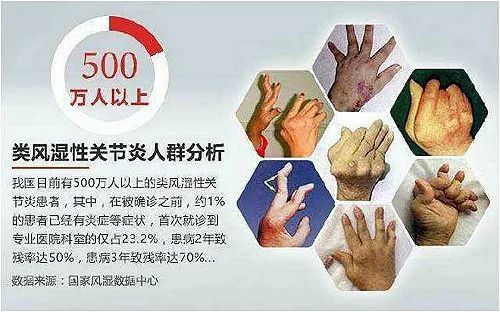 正康骨科医师提醒:关于类风湿,请走出这些误区!