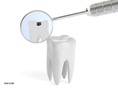 补牙一次搞不定?来回补牙的原因在这里