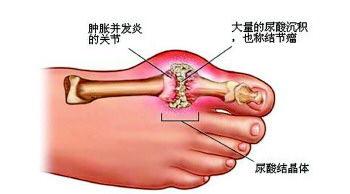 src=http_%2F%2Fwww.qianhai.com%2Fuploads%2Fallimg%2F180901%2F23-1PZ1105H0449.jpg&refer=http_%2F%2Fwww.qianhai.jpg