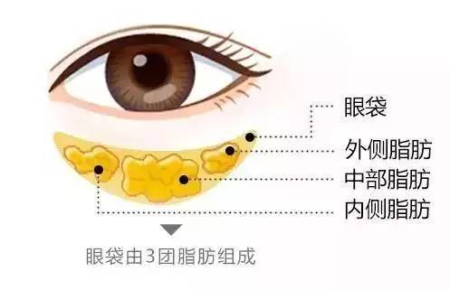 眼袋形成