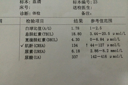 痛风肾超声表现图片