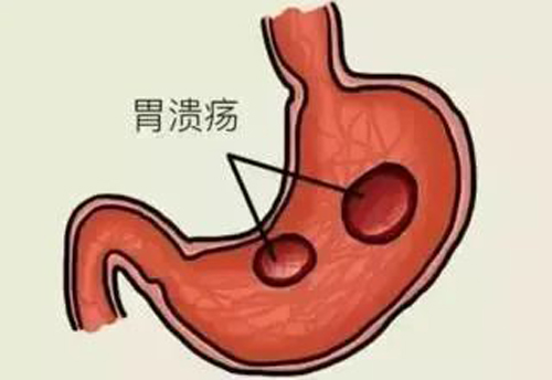 g.jpg