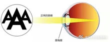 老花眼的成像