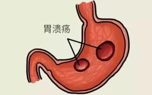 e.jpg