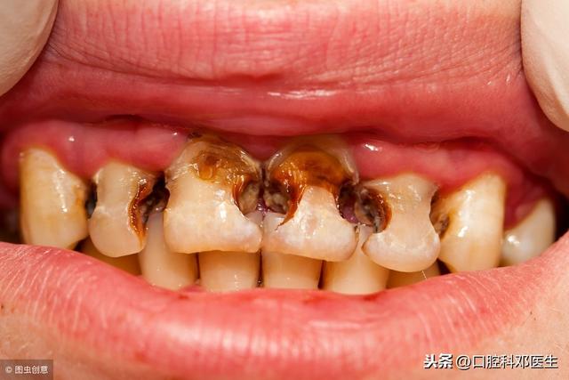牙齿求救的8个信号请别忽视，你收到了吗？