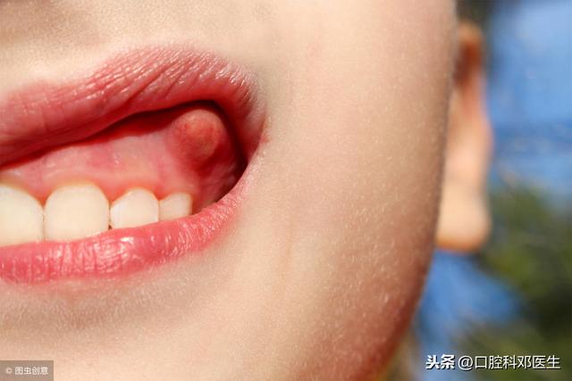 牙齿求救的8个信号请别忽视，你收到了吗？