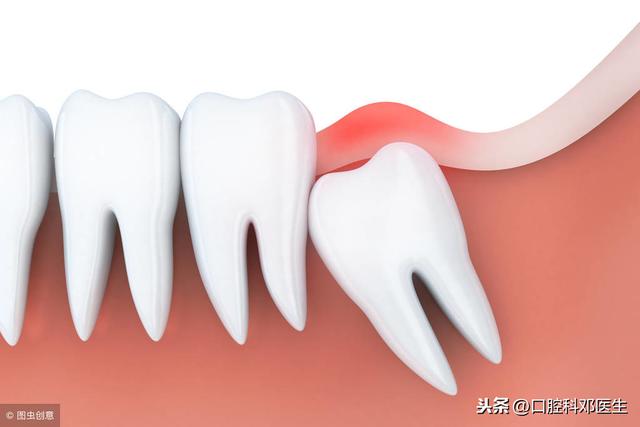 智齿也分三六九等，看看你属于几等？