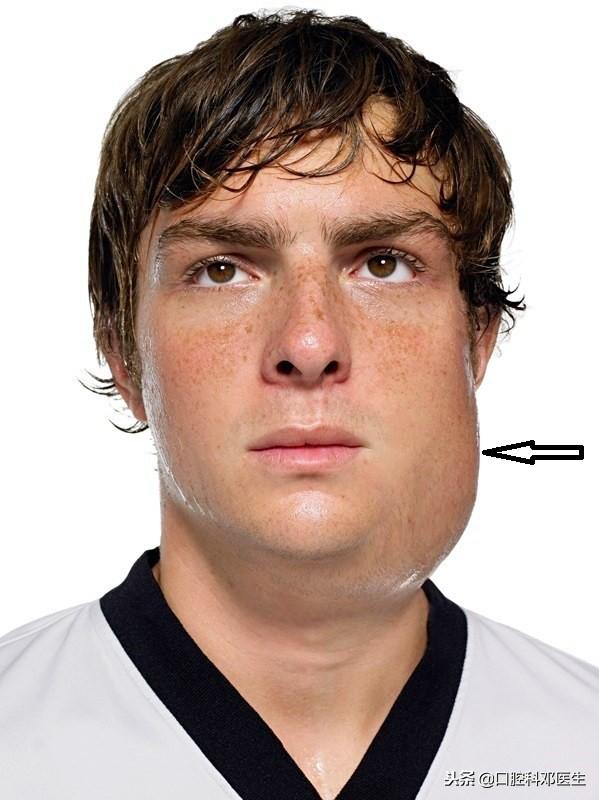 冰雪天气，专家支招应对5类口腔疾病