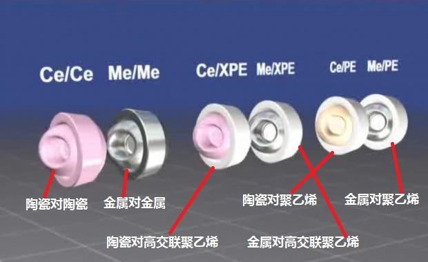 髋关节置换手术中内植物材料该如何选择？骨科医生告诉你