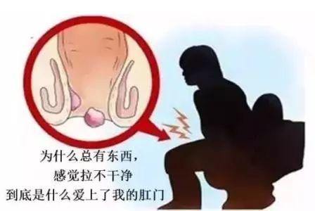 肛窦炎百科图片