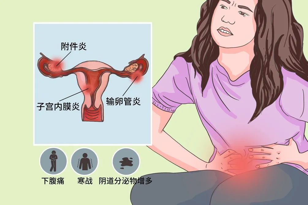 子宫内膜炎卡通图片图片