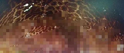 吓坏了！中年男子肠道长出“豹纹”……罪魁祸首竟是很多人常吃的……