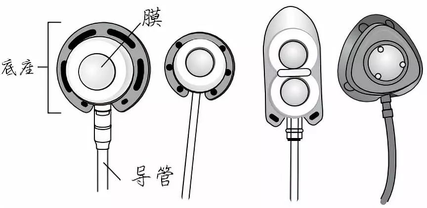 什么是"输液港"?