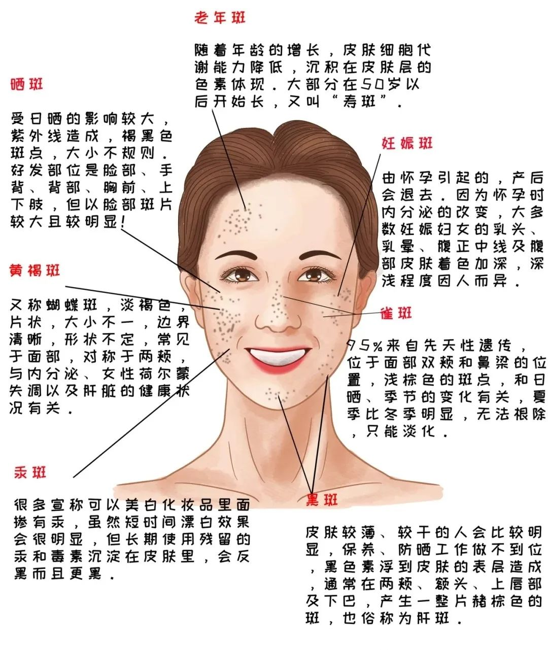 面部斑点图片解析图片