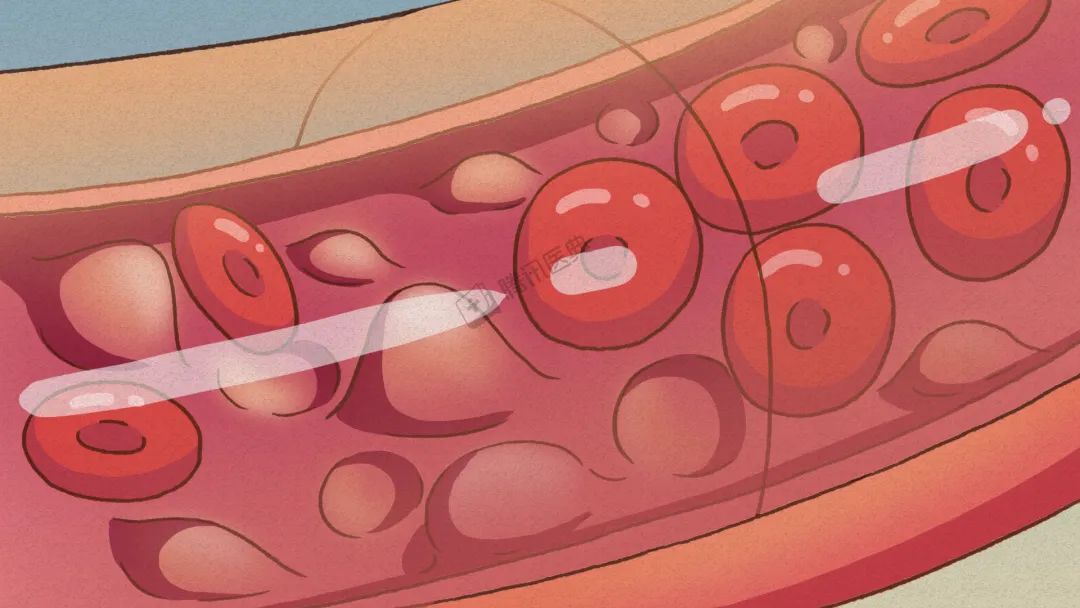 血管卡通图图片