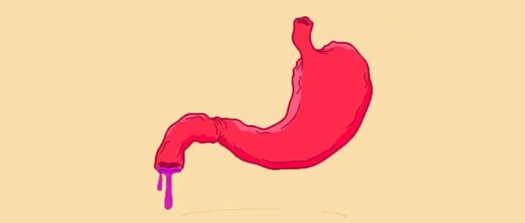 胃痛腹胀一个月，一查竟是这种癌！出现这7个症状时，一定要注意！