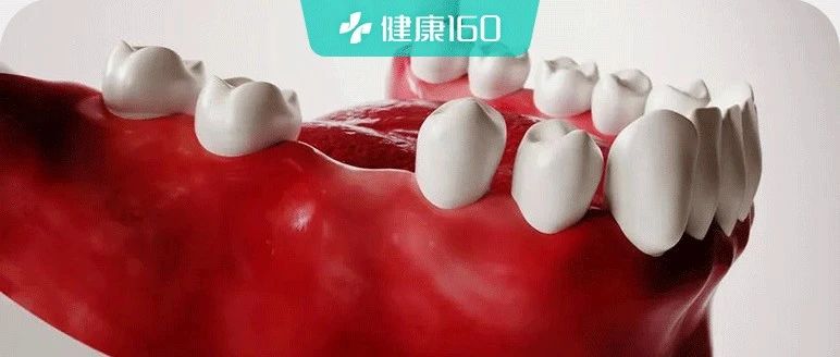 种植牙要降价了？缺牙问题还能拖多久？国家医保局做出了回应......