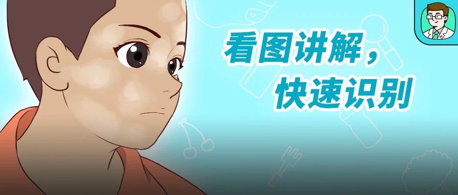 同样是白斑，白色糠疹和白癜风如何区分？误判后果严重！