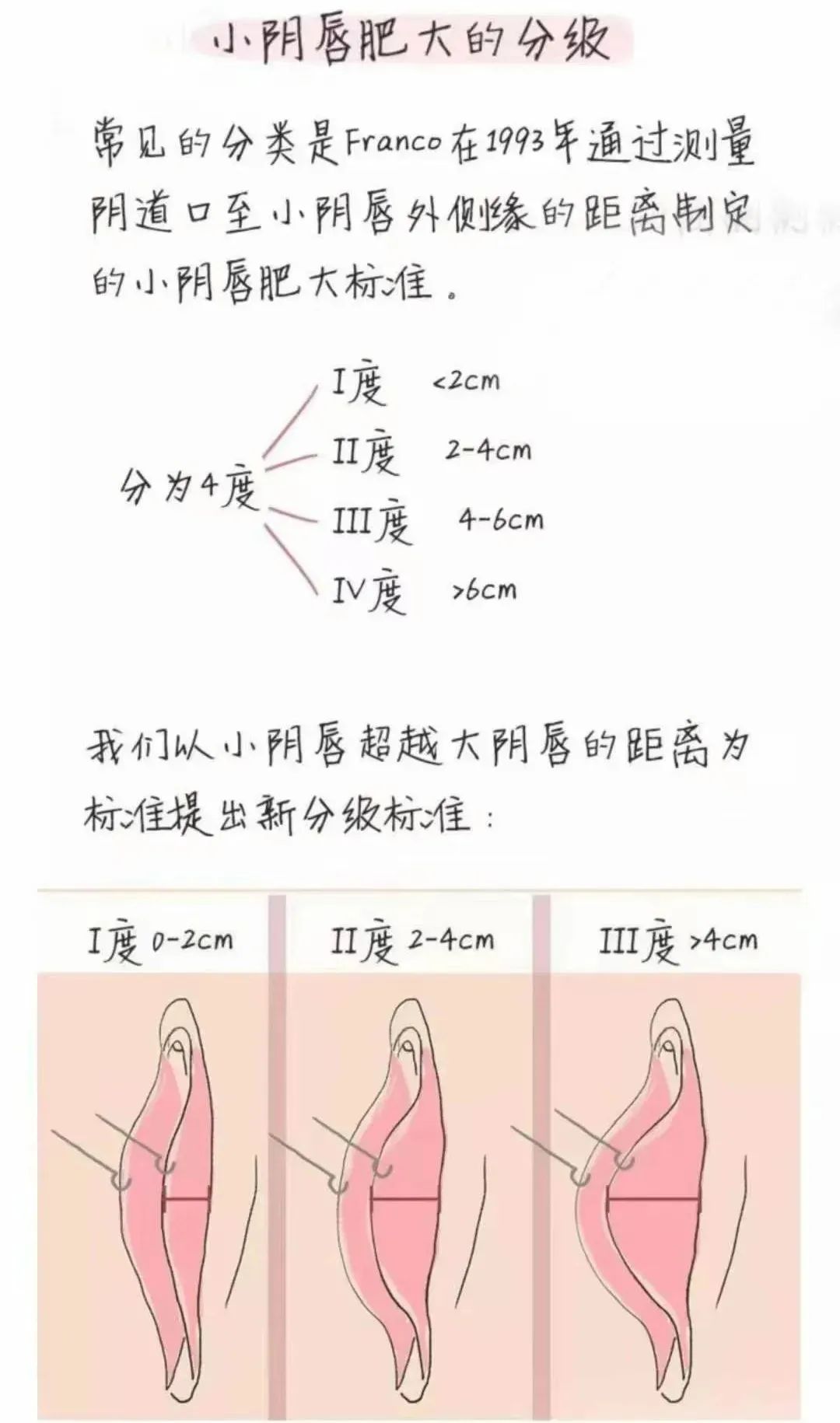 小阴唇 