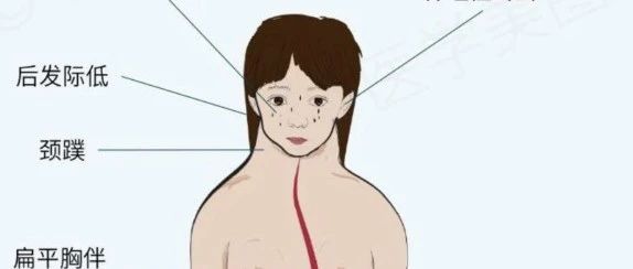一种只有女娃娃才会得的病--特纳综合征，你知道吗？