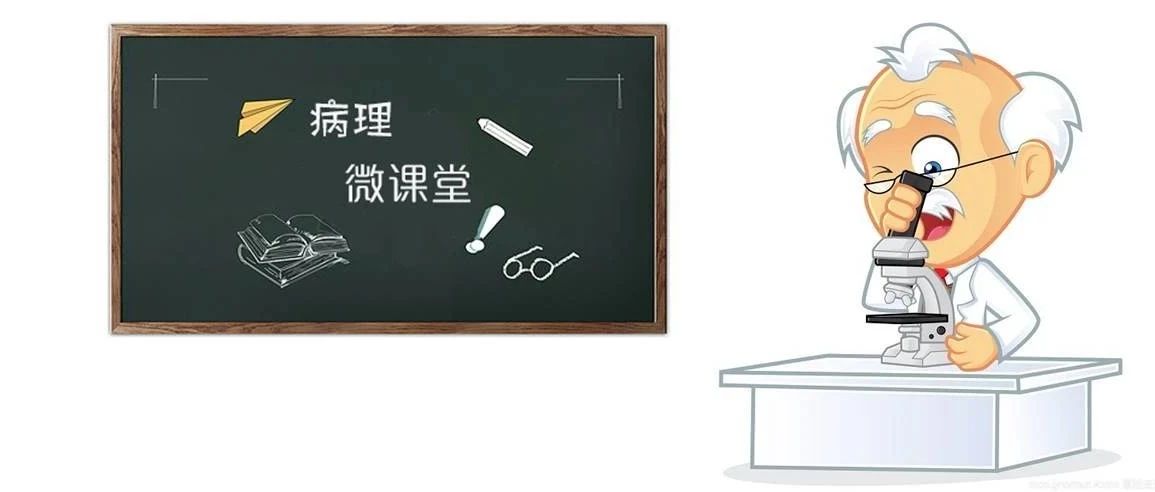 病理微课堂之炎性肌纤维母细胞性肿瘤
