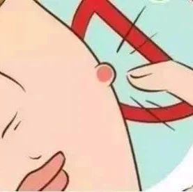 科普||毛囊闭锁三联征