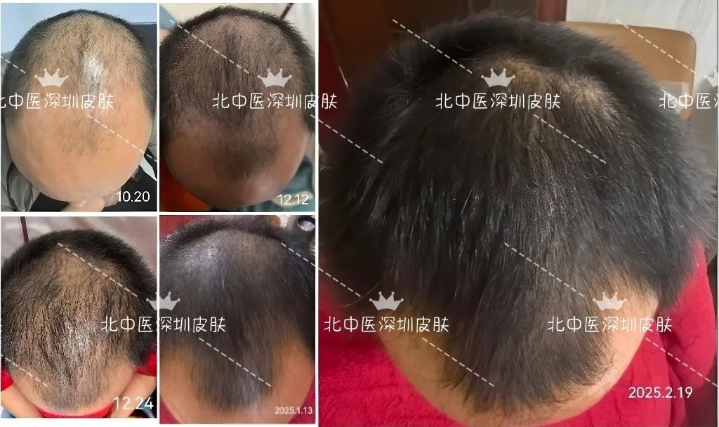 35e3b9314b41cc025cc8383b914b1357_compress.jpg