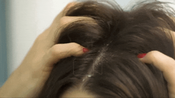 94151a9d2d403d1fabdb640f272c3f15_cd7fbc064b887ea657c34bab6761f2bb.gif